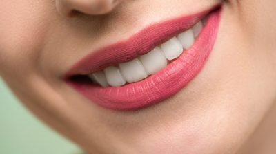 3 Options to Fix Crowded Teeth in Adults