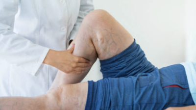 Mindful Vein Health: The Connection Between Stress and Circulation
