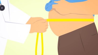 obese-3011213_1280