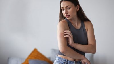 woman-suffering-from-rash